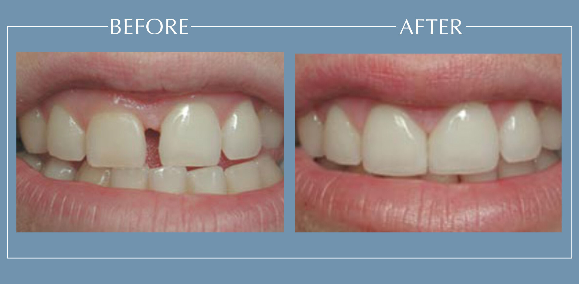Meadow Brook Dentistry: Cultivating Healthy Smiles in the Heart of Spearfish, SD