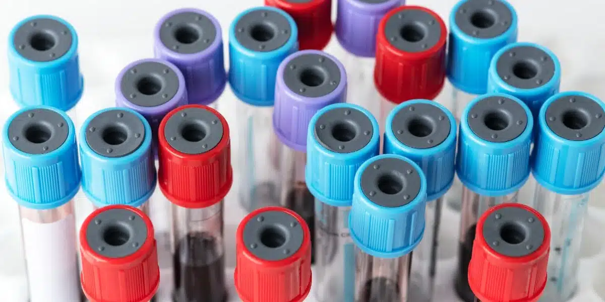 How Many Different Types of Blood Collection Tubes Are There?