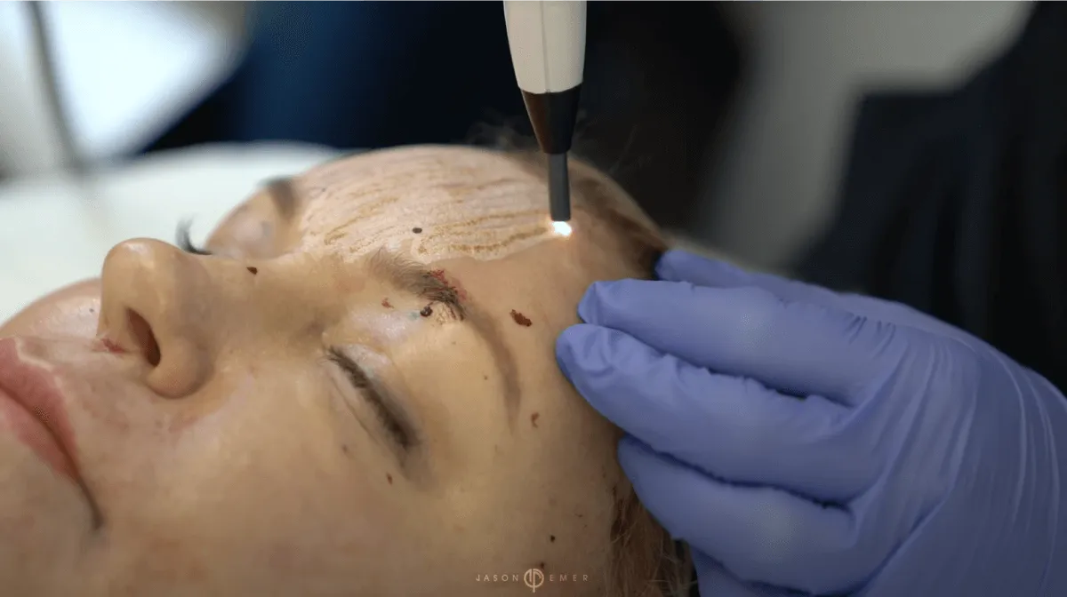 Revolutionizing Aesthetics: Explore Body Sculpting in Miami and Peptide Therapy Innovations