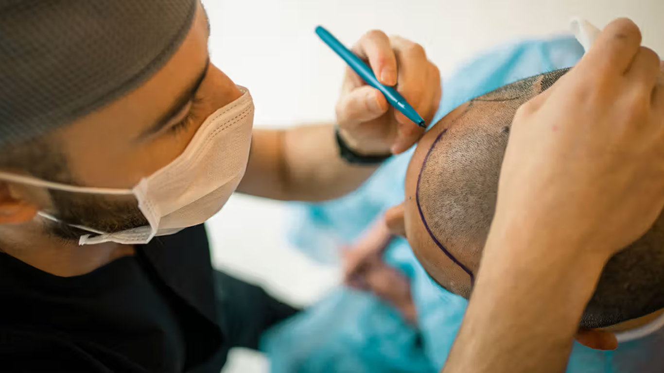 Say goodbye to your hair loss woes and hello to a more confident you.