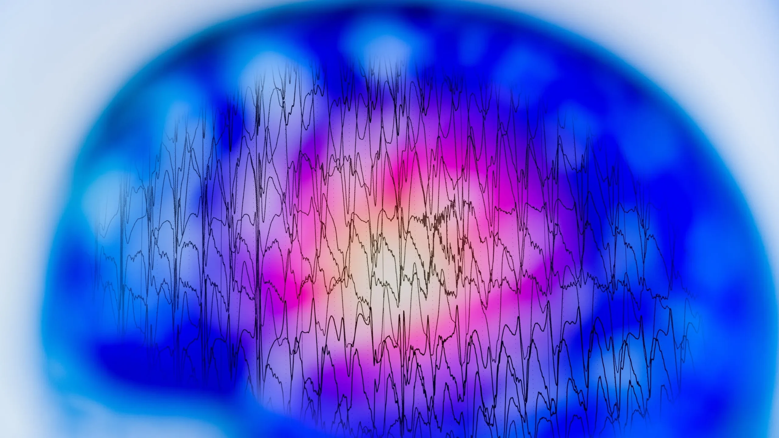 How Neurologists Help Patients With Epilepsy